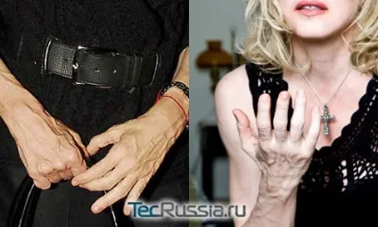 Мадонна - фото до і після пластичних операцій (пластичні операції) Мадонна - фото до і після пластичних операцій