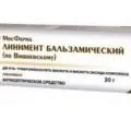 Мазь від варикозу своїми руками народні кошти на допомогу (своїми) Мазь від варикозу своїми руками народні кошти на допомогу