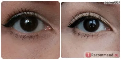 Наклейки для повік eyetape - «безопераційна підтяжка повік в домашніх умовах за сущі копійки (eyetape) Наклейки для повік eyetape - «безопераційна підтяжка повік в домашніх умовах за сущі копійки