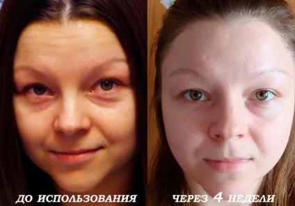 My perfect cream наука на службі краси - тест-драйв (пологи) My perfect cream наука на службі краси - тест-драйв