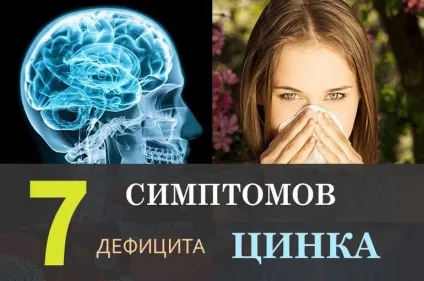 Недолік цинку в організмі симптоми у жінок і чоловіків (повинні обмежити споживання) Недолік цинку в організмі симптоми у жінок і чоловіків