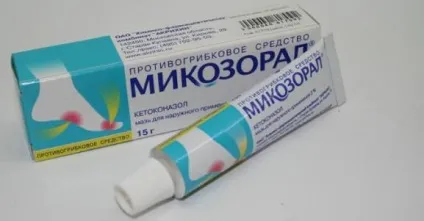Нігтьової грибок на ногах лікування, препарати, ліки (нігтьової) Нігтьової грибок на ногах лікування, препарати, ліки