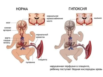 НСГ у новонароджених і грудних дітей особливості діагностики головного мозку (особливо) НСГ у новонароджених і грудних дітей особливості діагностики головного мозку
