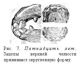 Визначення віку коні