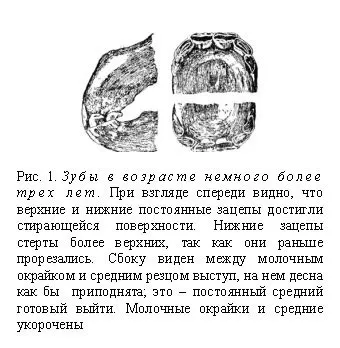 Визначення віку коні