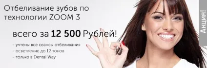 Відбілювання зубів, ціни і вартість в москві від 11 989 руб (вартість) Відбілювання зубів, ціни і вартість в москві від 11 989 руб