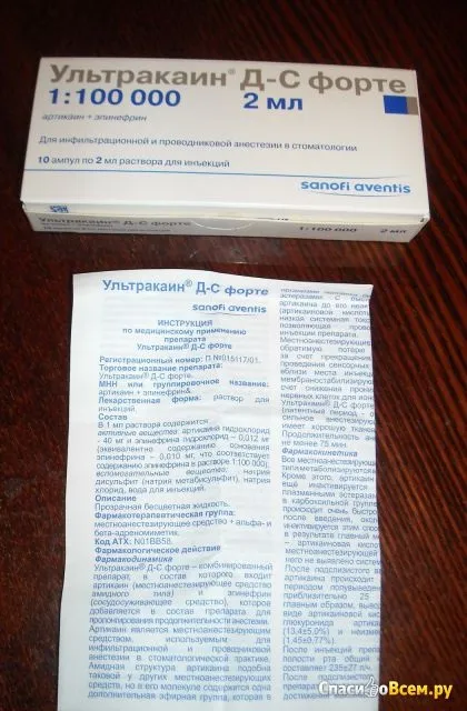 Відгук про препарат ультракаїн д-з форте sanofi-aventis а з ним щось дійсно не боляче! про