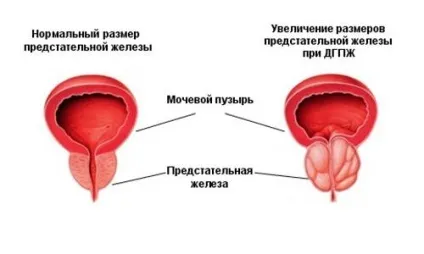 Бджолиний підмор і інші продукти бджільництва від простатиту (бджільництва) Бджолиний підмор і інші продукти бджільництва від простатиту