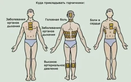 Як зробити гірчичники в домашніх умовах з сухої гірчиці правильно (домашніх) Як зробити гірчичники в домашніх умовах з сухої гірчиці правильно