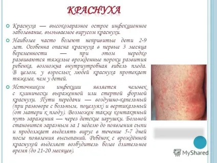 Презентація на тему презентація на тему дитячі інфекційні захворювання (презентація на тему: дитячі інфекційні захворювання.) Презентація на тему презентація на тему дитячі інфекційні захворювання