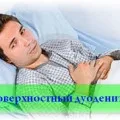 Проксимальний дуоденіт особливості захворювання та лікування (дуоденіт) Проксимальний дуоденіт особливості захворювання та лікування