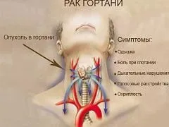 Рак шийки, симптоми захворювання і його лікування (злоякісних пухлин досить) Рак шийки, симптоми захворювання і його лікування