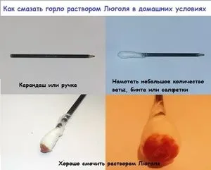 Розчин і спрей люголь, показання, спосіб застосування і терапевтичні властивості (показання) Розчин і спрей люголь, показання, спосіб застосування і терапевтичні властивості