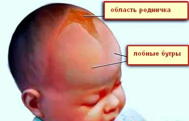 Родничок у новонароджених коли заростає - види джерелець, норми і патології! (Норми) Родничок у новонароджених коли заростає - види джерелець, норми і патології!