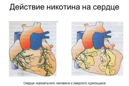 Серце курця вплив куріння на серцево-судинну систему (куріння) Серце курця вплив куріння на серцево-судинну систему