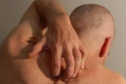 Висип при гепатиті причини і способи лікування (висип) Висип при гепатиті причини і способи лікування