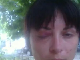 Слідчі ск Україна почали перевірку після виявлення тіла чоловіка в під'їзді будинку в Мітіно (під'їзді) Слідчі ск Україна почали перевірку після виявлення тіла чоловіка в під'їзді будинку в Мітіно