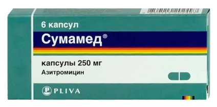 Термін лікування ангіни