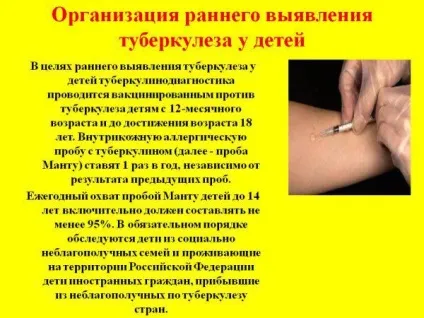 Туберкульоз у дітей симптоми, перші ознаки, діагностика, профілактика, лікування (туберкульоз) Туберкульоз у дітей симптоми, перші ознаки, діагностика, профілактика, лікування