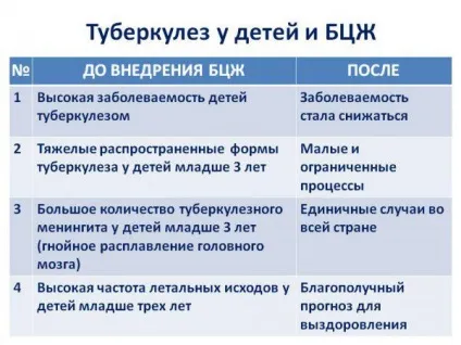 Туберкульоз у дітей симптоми, перші ознаки, діагностика, профілактика, лікування (симптоми) Туберкульоз у дітей симптоми, перші ознаки, діагностика, профілактика, лікування