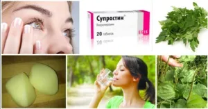 Вкусила мошка перша допомога, поради та рецепти по лікуванню