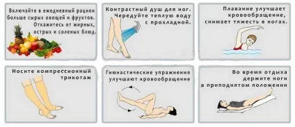 Вправи для профілактики варикозу (вправи для профілактики варикозу) Вправи для профілактики варикозу