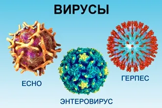 Вірусний фарингіт - симптоми і лікування дорослих і дітей