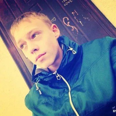 Витягування зубів, які сидять в яснах (перед установкою брекетів) Витягування зубів, які сидять в яснах