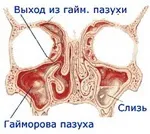 Все про гаймориті