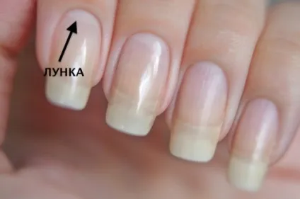 Білі лунки біля основи нігтя це нормально, красиві нігті - додаток твого образу (нігтя) Білі лунки біля основи нігтя це нормально, красиві нігті - додаток твого образу