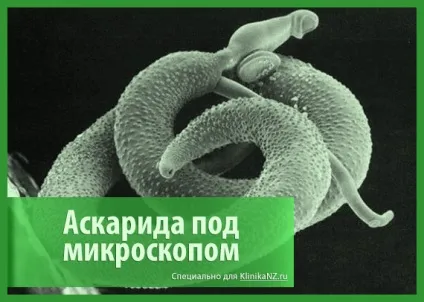 Аскаридоз у дітей способи зараження, симптоми і лікування аскарид у дитини (дітей) Аскаридоз у дітей способи зараження, симптоми і лікування аскарид у дитини