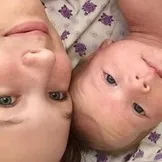 Болить шкіра як при опіку