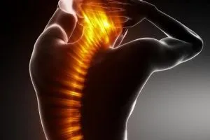 Чи беруть в армію зі сколіозом 1, 2, 3, 4 ступеня від чого це залежить, обгрунтування і нюанси (сколіоз) Чи беруть в армію зі сколіозом 1, 2, 3, 4 ступеня від чого це залежить, обгрунтування і нюанси