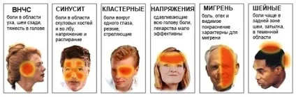 Болить шия і потилицю, причини болю ззаду, лікування, чому, від чого (болі) Болить шия і потилицю, причини болю ззаду, лікування, чому, від чого