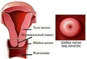 Цервікальний канал зімкнуть що це таке (таке) Цервікальний канал зімкнуть що це таке