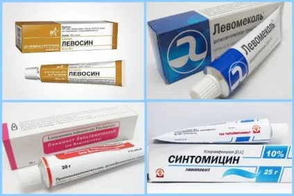 Фурункул на руці, як лікувати фурункульоз чиряк ліктя пальця (фурункул) Фурункул на руці, як лікувати фурункульоз чиряк ліктя пальця