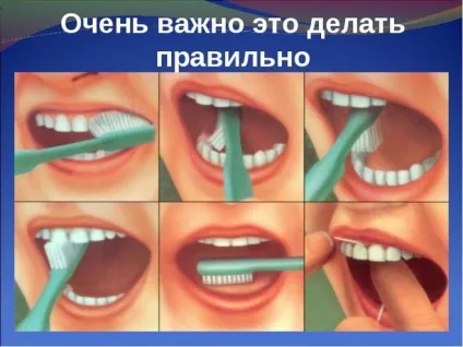 Яких вітамінів не вистачає організму коли руйнуються, кришаться зуби (вітамінів) Яких вітамінів не вистачає організму коли руйнуються, кришаться зуби