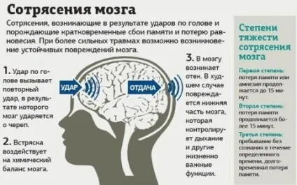 Як зрозуміти, що у вас стався струс мозку (струсу головного мозку) Як зрозуміти, що у вас стався струс мозку