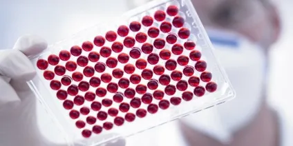Як протікає гіпертиреоз у котів і кішок симптоми гіпертиреозу і лікування кота (гіпертиреоз) Як протікає гіпертиреоз у котів і кішок симптоми гіпертиреозу і лікування кота