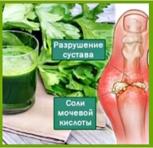 Лікування подагри народними засобами (хворі суглоби зверху) Лікування подагри народними засобами