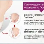 Масаж голови для росту волосся, від випадіння, відгуки, відео (зростання) Масаж голови для росту волосся, від випадіння, відгуки, відео