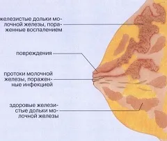 Містить - лікування, симптоми, причини