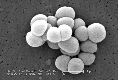 Мікрококи лютеус (micrococcus luteus)