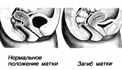 Місячні густі і темного кольору причини (густі) Місячні густі і темного кольору причини
