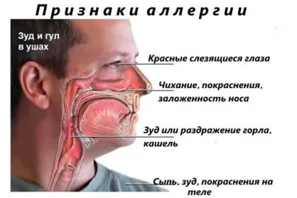 Нежить і сльозяться очі (сльозяться) Нежить і сльозяться очі