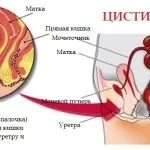Отруєння при грудному вигодовуванні симптоми і лікування (отруєння мама, яка годує грудне вигодовування лактація гв лікування блювання пити якщо робити дитина комаровский після через) Отруєння при грудному вигодовуванні симптоми і лікування