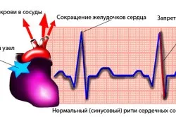 Чи небезпечна синусовааритмія - лікування серця (синусова) Чи небезпечна синусовааритмія - лікування серця