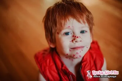 Від чого призначають фукорцин (небажано застосовувати препарат) Від чого призначають фукорцин