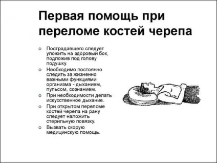 Перелом черепа наслідки методи лікування фото і відео (наслідки) Перелом черепа наслідки методи лікування фото і відео
