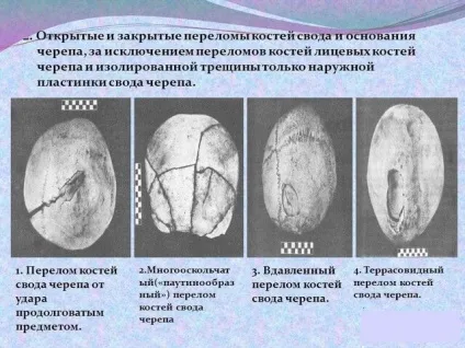 Перелом черепа наслідки методи лікування фото і відео (наслідки) Перелом черепа наслідки методи лікування фото і відео